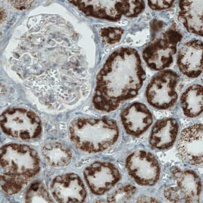 Immunohistochemistry-Paraffin: MACC1 Antibody (CL0856) [NBP2-52955] - Staining of human kidney shows strong cytoplasmic immunoreactivity in renal tubules.