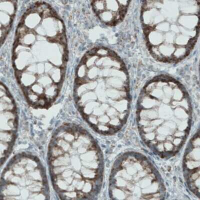 Immunohistochemistry-Paraffin: MACC1 Antibody (CL0856) [NBP2-52955] - Staining of human rectum shows strong cytoplasmic immunoreactivity in glandular cells.