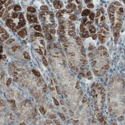 Immunohistochemistry-Paraffin: MACC1 Antibody (CL0856) [NBP2-52955] - Staining of human stomach shows cytoplasmic positivity in glandular cells.