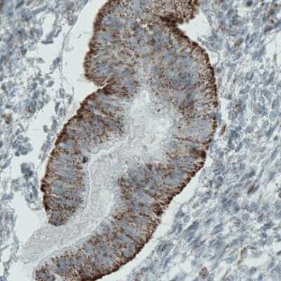 Immunohistochemistry-Paraffin: MACC1 Antibody (CL0856) [NBP2-52955] - Staining of human uterus shows cytoplasmic positivity in glandular, but not stroma cells.