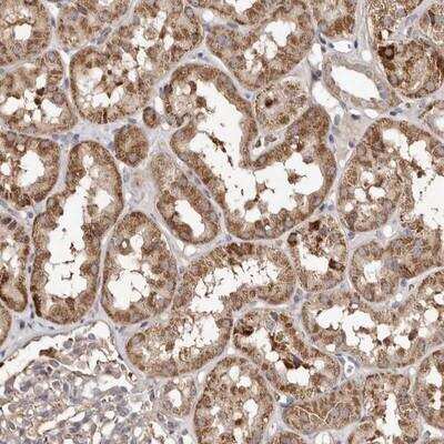 Immunohistochemistry: MACC1 Antibody [NBP1-89353] - Staining of human kidney shows moderate cytoplasmic positivity in cells in tubules.