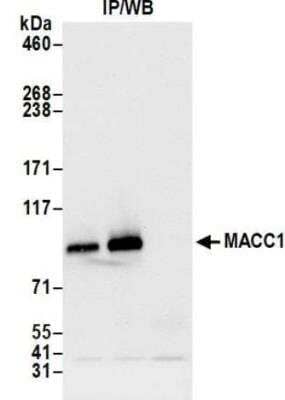 Immunoprecipitation: MACC1 Antibody [NBP3-14716] - Whole cell lysate (1.0 mgper IP reaction; 20% of IP loaded) from cellsprepared using NETN lysis buffer. Antibodies: Rabbit antiMACC1 recombinant monoclonal antibody used for IP at 20 ul/mg lysate. MACC1was also immunoprecipitated by rabbit anti-MACC1antibody. For blotting immunoprecipitatedMACC1,  was used at 1:1000.Chemiluminescence with an exposure time of 3 seconds.