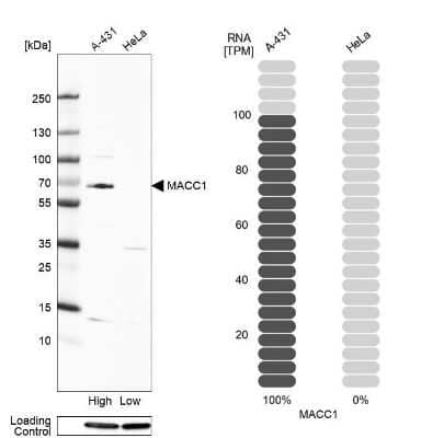 Western Blot: MACC1 Antibody [NBP1-89351] - Analysis in human cell line A-431 and human cell line HeLa.