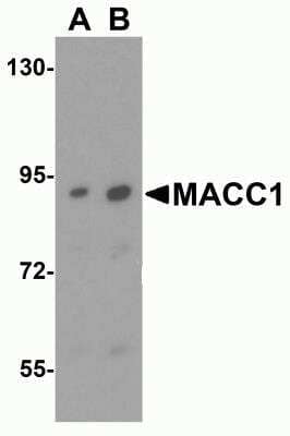 Western Blot: MACC1 Antibody [NBP2-82006] - Analysis of MACC1 expression in human liver tissue lysate with MACC1 antibody at (A) 1 and (B) 2 ug/ml.