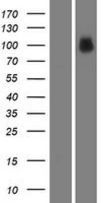 Western Blot: MACC1 Overexpression Lysate (Adult Normal) [NBP2-04803] Left-Empty vector transfected control cell lysate (HEK293 cell lysate); Right -Over-expression Lysate for MACC1.