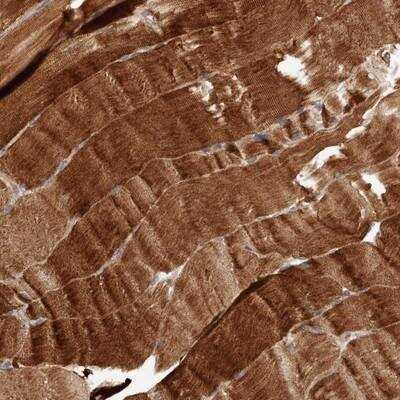 Immunohistochemistry: MACF1 Antibody [NBP1-89299] - Staining of human skeletal muscle shows strong cytoplasmic positivity in myocytes.