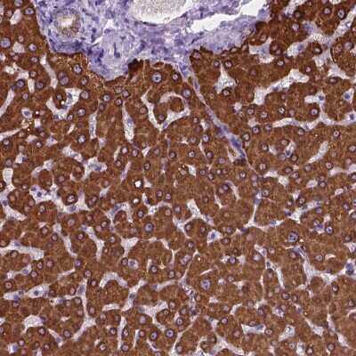 Immunohistochemistry: MACF1 Antibody [NBP2-49542] - Staining of human liver shows strong cytoplasmic positivity in hepatocytes.