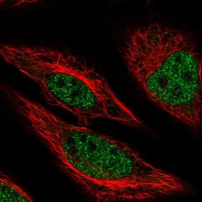 Immunocytochemistry/ Immunofluorescence MACROD1 Antibody - BSA Free
