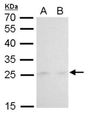 <b>Genetic Strategies Validation. </b>Western Blot: MAD2L1 Antibody (1761) [NBP2-43820] - Analysis of A. 30 ug Jurkat whole cell lysate/extract B. 30 ug Raji whole cell lysate/extract 12 % SDS-PAGE MAD2L1 antibody [1761] dilution: 1:250.