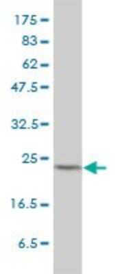 Western Blot: MAD2L1 Antibody (2E2-1D6) [H00004085-M01] - MAD2L1 monoclonal antibody (M01), clone 2E2-1D6 Analysis of MAD2L1 expression in HeLa.