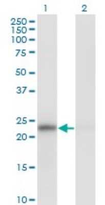 Western Blot: MAD2L1 Antibody (2E2-1D6) [H00004085-M01] - Analysis of MAD2L1 expression in transfected 293T cell line by MAD2L1 monoclonal antibody (M01), clone 2E2-1D6.Lane 1: MAD2L1 transfected lysate(23.5 KDa).Lane 2: Non-transfected lysate.