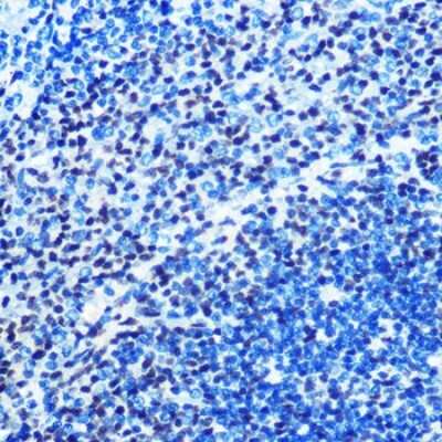 Immunohistochemistry-Paraffin: MAD2L1 Antibody (5W5U1) [NBP3-15384] - Immunohistochemistry of paraffin-embedded rat spleen using MAD2/MAD2L1 Rabbit mAb (NBP3-15384) at dilution of 1:100 (40x lens).Perform microwave antigen retrieval with 10 mM PBS buffer pH 7.2 before commencing with IHC staining protocol.