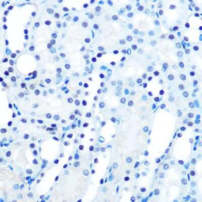 Immunohistochemistry-Paraffin: MAD2L1 Antibody (5W5U1) [NBP3-15384] - Immunohistochemistry of paraffin-embedded mouse kidney using MAD2/MAD2L1 Rabbit mAb (NBP3-15384) at dilution of 1:100 (40x lens).Perform microwave antigen retrieval with 10 mM PBS buffer pH 7.2 before commencing with IHC staining protocol.