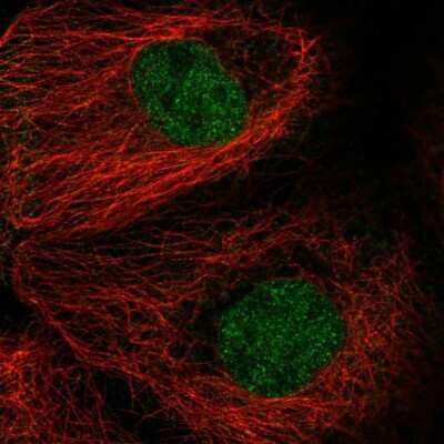 Immunocytochemistry/Immunofluorescence: MAD2L1 Antibody [NBP1-83185] - Immunofluorescent staining of human cell line A-431 shows localization to nucleoplasm.