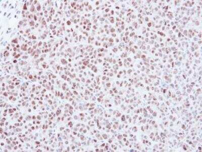 Immunohistochemistry-Paraffin: MAD2L1 Antibody [NBP1-31311] - DLD-1 xenograft, using Mad2L1 antibody at 1:500 dilution. Antigen Retrieval: Trilogy™ (EDTA based, pH 8.0) buffer, 15min.