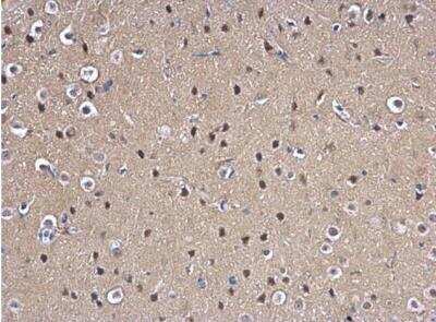 Immunohistochemistry-Paraffin: MAD2L1 Antibody [NBP1-31311] -  Rat fore brain. MAD2L1 antibody [C2C3], C-term dilution: 1:500. Antigen Retrieval: Trilogy™ (EDTA based, pH 8.0) buffer, 15min.