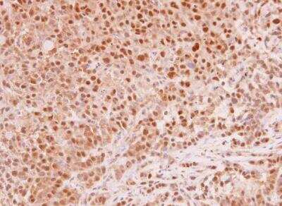 Immunohistochemistry-Paraffin: MAD2L1 Antibody [NBP1-31311] - Human A549 xenograft . MAD2L1 antibody [C2C3], C-term  diluted at 1:250. Antigen Retrieval: Trilogy™ (EDTA based, pH 8.0) buffer, 15min.