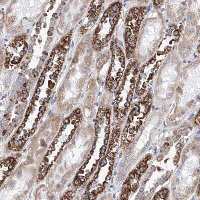 Immunohistochemistry-Paraffin: MAD2L1 Antibody [NBP1-83185] - Staining of human kidney shows strong cytoplasmic positivity in distal tubules.