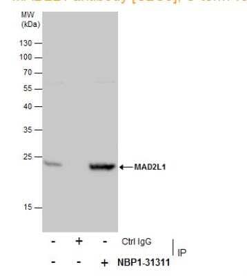 Immunoprecipitation: MAD2L1 Antibody [NBP1-31311] - MAD2L1 protein from 293T whole cell extracts using 5 ug of MAD2L1 antibody [C2C3], C-term (NBP1-31311). Western blot analysis was performed using MAD2L1 antibody [C2C3], C-term (NBP1-31311). EasyBlot anti-Rabbit IgG was used as a secondary reagent.