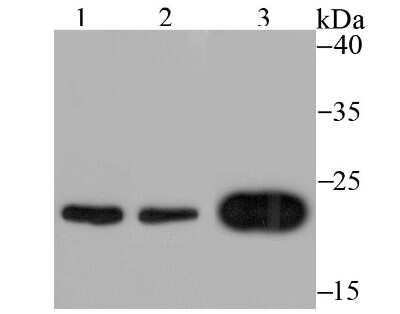 Western Blot: MAD2L1 Antibody (JU46-13) [NBP2-75561] - Analysis of Mad2L1 on different cell lysates using anti-Mad2L1 antibody at 1/500 dilution.Positive control:Lane 1: K562       Lane 2: 293TLane 3: SH-SY5Y
