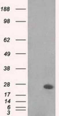 Western Blot: MAD2L1 Antibody (OTI4D2) - Azide and BSA Free [NBP2-72565] - HEK293T cells were transfected with the pCMV6-ENTRY control (Left lane) or pCMV6-ENTRY Mad2L1 (Right lane) cDNA for 48 hrs and lysed. Equivalent amounts of cell lysates (5 ug per lane) were separated by SDS-PAGE and immunoblotted with anti-Mad2L1.