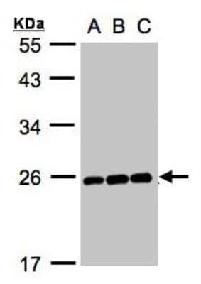 Western Blot: MAD2L1 Antibody [NBP1-31311] - A:Hep G2 B:MOLT4  C:Raji 12% SDS PAGE NBP1-31311 diluted at 1:1000