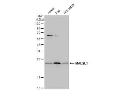 Western Blot: MAD2L1 Antibody [NBP1-31311] - Various whole cell extracts (30 ug) were separated by 12% SDS-PAGE, and the membrane was blotted with MAD2L1 antibody [C2C3], C-term diluted at 1:1000. The HRP-conjugated anti-rabbit IgG antibody (NBP2-19301) was used to detect the primary antibody.