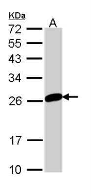 <b>Genetic Strategies Validation. </b>Western Blot: MAD2L1 Antibody [NBP1-33529] - Sample (30 ug of whole cell lysate) A: 293T 12% SDS PAGE; antibody diluted at 1:1000.