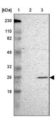 Western Blot: MAD2L1 Antibody [NBP1-83185] - Lane 1: Marker  [kDa] 230, 110, 82, 49, 32, 26, 18.   Lane 2: Human cell line RT-4.  Lane 3: Human cell line U-251MG sp