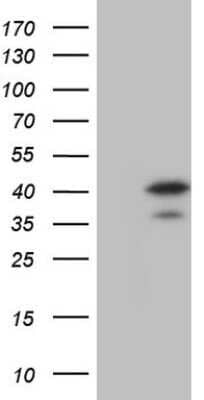 Western Blot: MAD2L1-binding protein Antibody (OTI3C11) - Azide and BSA Free [NBP2-72566] - Analysis of HEK293T cells were transfected with the pCMV6-ENTRY control (Left lane) or pCMV6-ENTRY MAD2L1- binding protein.