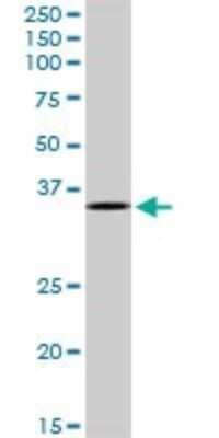 Western Blot: MAD2L1-binding protein Antibody [H00009587-B01P] - Analysis of MAD2L1BP expression in A-431.
