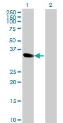 Western Blot: MAD2L1-binding protein Antibody [H00009587-B01P] - Analysis of MAD2L1BP expression in transfected 293T cell line by MAD2L1BP polyclonal antibody.  Lane 1: MAD2L1BP transfected lysate(30.25 KDa). Lane 2: Non-transfected lysate.