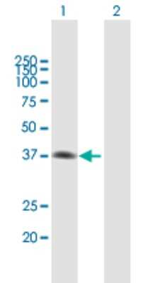 Western Blot: MAD2L1-binding protein Antibody [H00009587-B02P] - Analysis of MAD2L1BP expression in transfected 293T cell line by MAD2L1BP polyclonal antibody.  Lane 1: MAD2L1BP transfected lysate(33.66 KDa). Lane 2: Non-transfected lysate.