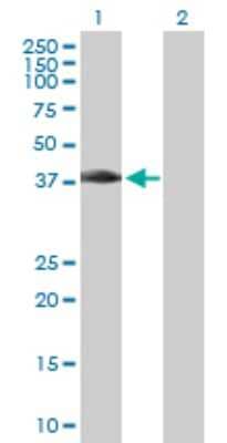 Western Blot: MAD2L1-binding protein Antibody [H00009587-D01P] - Analysis of MAD2L1BP expression in transfected 293T cell line by MAD2L1BP polyclonal antibody.Lane 1: MAD2L1BP transfected lysate(34.70 KDa).Lane 2: Non-transfected lysate.