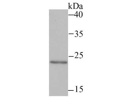 Western Blot: MAD2L2 Antibody (JU99-23) [NBP2-75562] - Analysis of Mad2L2 on SiHa cell using anti-Mad2L2 antibody at 1/500 dilution.