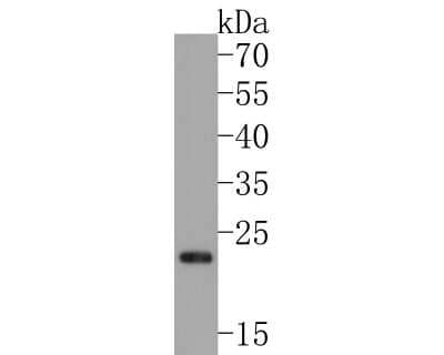 Western Blot: MAD2L2 Antibody (JU99-23) [NBP2-75562] - Analysis of MAD2L2 on K562 cell lysates with Rabbit anti-Mad2L2 antibody at 1/500 dilution. Lysates/proteins at 10 ug/Lane. Predicted band size: 24 kDa Observed band size: 24 kDa Exposure time: 2 minutes; 15% SDS-PAGE gel. Proteins were transferred to a PVDF membrane and blocked with 5% NFDM/TBST for 1 hour at room temperature. The primary antibody at 1/500 dilution was used in 5% NFDM/TBST at room temperature for 2 hours. Goat Anti-Rabbit IgG - HRP Secondary Antibody at 1:200,000 dilution was used for 1 hour at room temperature.