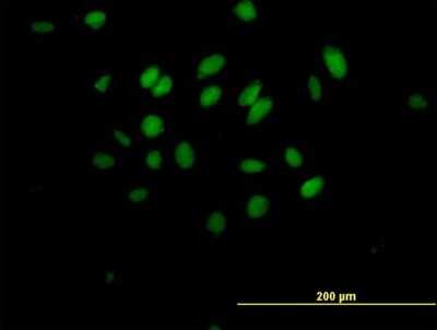 Immunocytochemistry/Immunofluorescence: MAD3 Antibody [H00083463-B01P] - Analysis of purified antibody to MXD3 on HeLa cell. (antibody concentration 10 ug/ml)