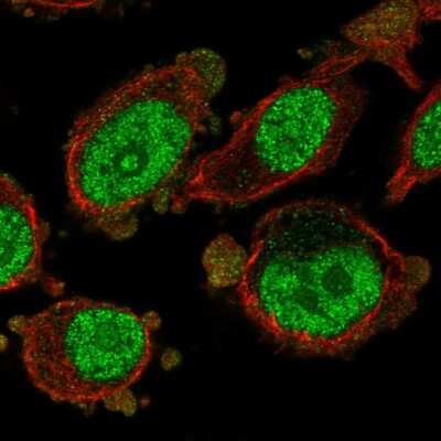 Immunocytochemistry/ Immunofluorescence MAD3 Antibody