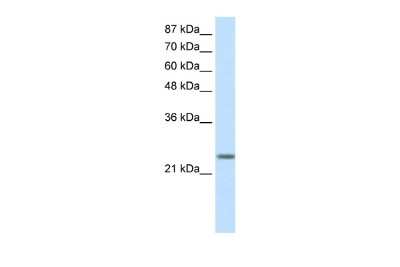 Western Blot: MAD3 Antibody [NBP2-87764] - WB Suggested Anti-MXD3 Antibody Titration: 0.5ug/ml. ELISA Titer: 1:312500. Positive Control: Transfected 293T