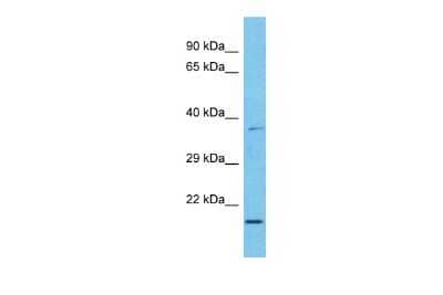 Western Blot: MAD3 Antibody [NBP2-87766] - Host: Rabbit. Target Name: MXD3. Sample Type: Esophagus Tumor lysates. Antibody Dilution: 1.0ug/ml