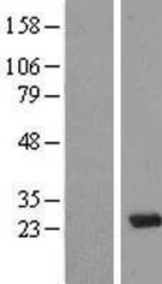 Western Blot MAD3 Overexpression Lysate