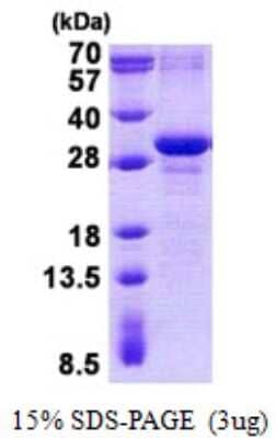 SDS-Page: MAD3 Protein [NBP2-23219]