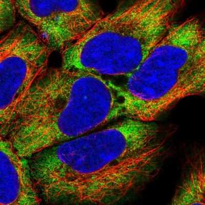 Immunocytochemistry/Immunofluorescence: MAD4 Antibody [NBP2-58767] - Staining of human cell line HEK 293 shows localization to cytosol.