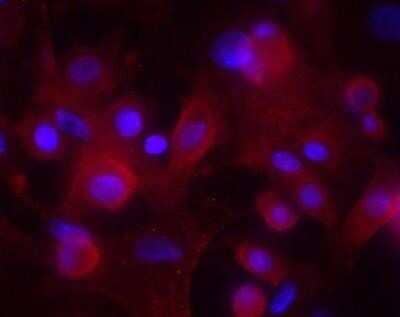 Flow Cytometry: MAD4 Antibody (OTI7F7) - Azide and BSA Free [NBP2-72567] - Human keratinocytes, PFA-fixed, permeabilization: PBS-Triton 0.1% 20 minutes at RT, primary antibody at 1:250 in PBS-2% BSA, secondary antibody conjugated to Alexa Fluor 594. Red: MAD4 antibody, Blue: DAPI. Image from verified customer review.