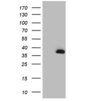 Western Blot: MAD4 Antibody (OTI7F7) - Azide and BSA Free [NBP2-72567] - HEK293T cells were transfected with the pCMV6- ENTRY control (Left lane) or pCMV6-ENTRY MXD4 cDNA for 48 hrs and lysed. Equivalent amounts of cell lysates (5 ug per lane) were separated by SDS-PAGE and immunoblotted with antiMXD4.(1:2000)