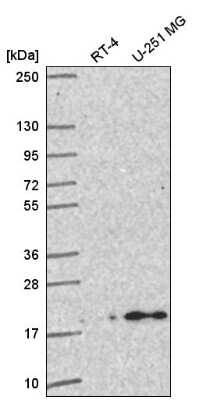 Western Blot: MAD4 Antibody [NBP2-58767] - Analysis in human cell line RT-4 and human cell line U-251 MG.