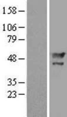 Western Blot: MAEL Overexpression Lysate (Adult Normal) [NBL1-12792] Left-Empty vector transfected control cell lysate (HEK293 cell lysate); Right -Over-expression Lysate for MAEL.