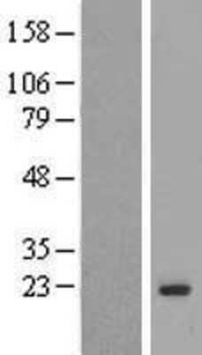 Western Blot: MAFG Overexpression Lysate (Adult Normal) [NBP2-09781] Left-Empty vector transfected control cell lysate (HEK293 cell lysate); Right -Over-expression Lysate for MAFG.