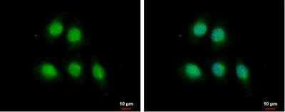 Immunocytochemistry/Immunofluorescence: MAGE 1 Antibody [NBP2-17202] - A375 cells were fixed in 4% paraformaldehyde at RT for 15 min. Green: MAGE 1 protein stained by MAGE 1 antibody [N1C3] diluted at 1:500. Blue: Hoechst 33342 staining.