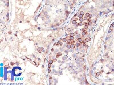 Immunohistochemistry-Paraffin: MAGE 1 Antibody (MA454) - Azide and BSA Free [NBP2-33094] - Formalin-fixed, paraffin-embedded human testis stained with MAGE-1 antibody (1:200), peroxidase-conjugate and DAB chromogen.
